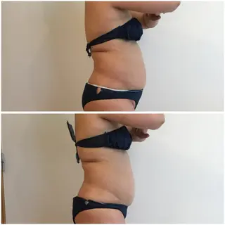 美容マッサージ Urichのエステ・リラクイメージ