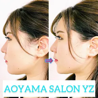 小顔美容鍼専門サロン 渋谷YZのエステ・リラクイメージ