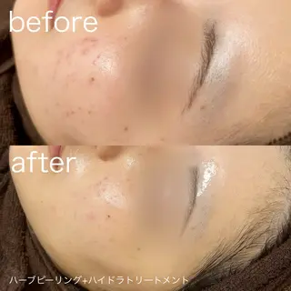 lulularico Yu🫧のエステ・リラクイメージ