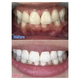 MBEAUTYSALON 千葉店・京成大久保所属・Melty 輝のその他イメージ