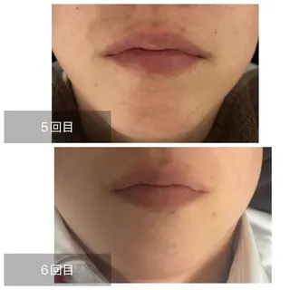 メンズ エマニエル USAのエステ・リラクイメージ