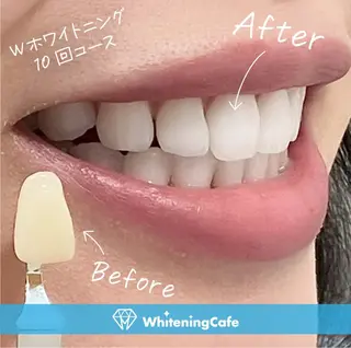 ホワイトニングカフェ神戸元町店所属・ホワイトニングカフェ 神戸元町店のエステ・リラクイメージ