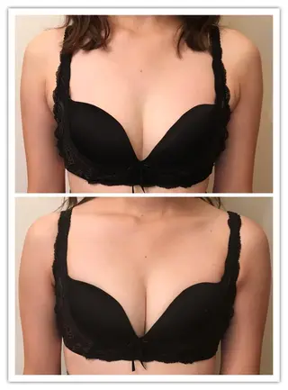 女性のお悩み美容 サロン ヴィーナスのエステ・リラクイメージ