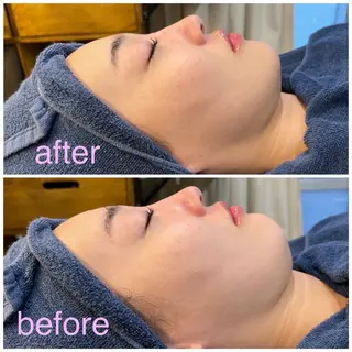 leolo武蔵浦和 肌質改善＆脱毛のエステ・リラクイメージ