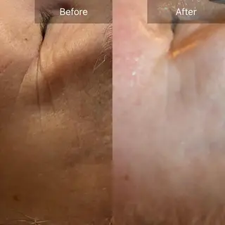 Mandarin Orange所属・毛穴から始める肌メン テマンダリンオレンジのエステ・リラクイメージ