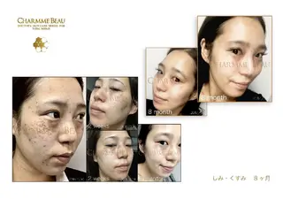 肌質改善サロン renew所属・肌質改善サロン renew/ウエキのエステ・リラクイメージ