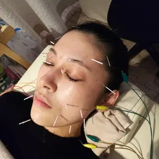 むくみたるみ専門☆ 美容鍼・小顔矯正のエステ・リラクイメージ