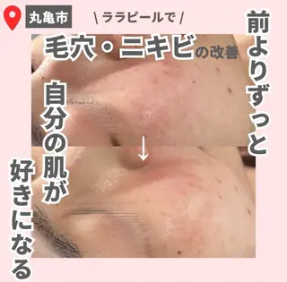 【LEPUS】 sekiのエステ・リラクイメージ