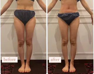 立体小顔×艶肌×美ボ ディ似合わせ施術 岡のエステ・リラクイメージ