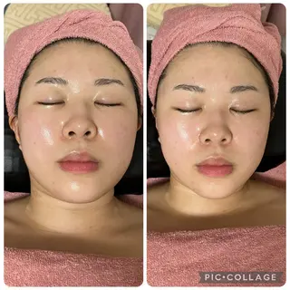 メディカルエステ　痩身·小顔専門サロンBBC 田園調布所属・KEI KOのエステ・リラクイメージ