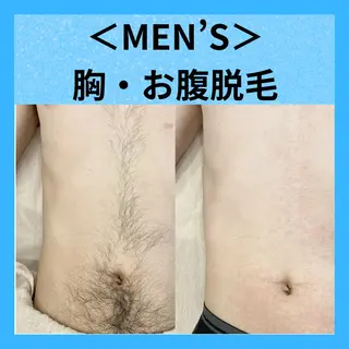 メンズ メディカルエステ マドンナのエステ・リラクイメージ