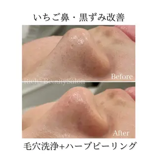 Rich+ ビューティーサロンのエステ・リラクイメージ