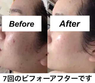 都度払い肌質改善 &脱毛Blancheのエステ・リラクイメージ