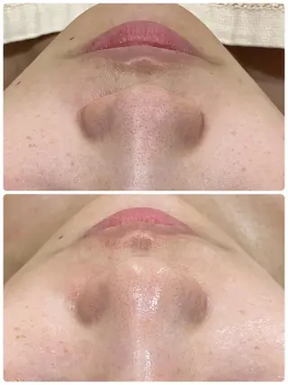 エステ矢野 ジョアアンジェ心斎橋のエステ・リラクイメージ