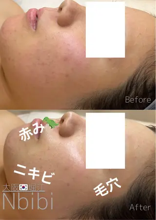 韓国🇰🇷価格 サロン_Nbibiのエステ・リラクイメージ