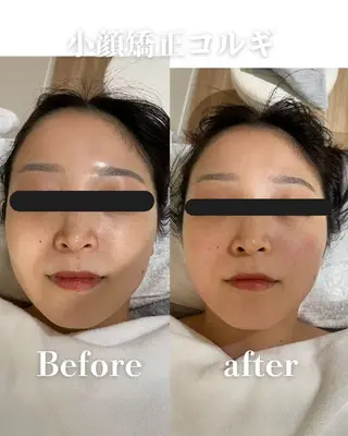 高岳/久屋大通　脱毛 コルギ🌿ENSHIのエステ・リラクイメージ