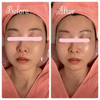 透明感の肌Lino malieのエステ・リラクイメージ