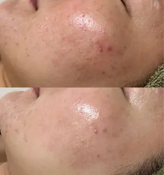 Beauty   Salon  Adiy所属・Adiy ikumiのエステ・リラクイメージ