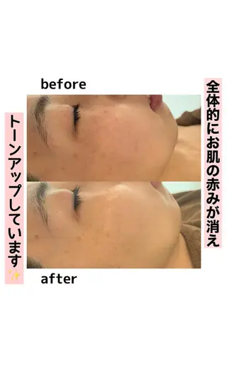 美肌コラーゲン脱毛SINCERITE【サンセリテ】所属・瀬野 のぞみのエステ・リラクイメージ
