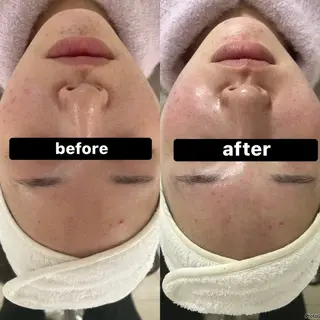 脱毛&Beauty salon IILA所属・垢抜けお手伝い💖 Sakuraの眉毛・アイブロウイメージ