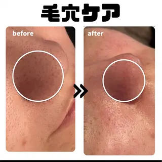 ローザエメ Reiaのエステ・リラクイメージ