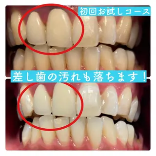 PLATINUM Beauty 横浜店所属・ホワイトニングルーム 横浜店のその他イメージ