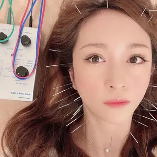 新宿hari-me所属・美容鍼hari-me 新宿のエステ・リラクイメージ