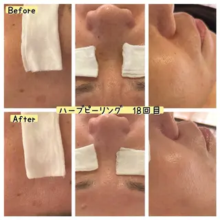 ぱんだ王国エステ所属・ぱんだ王国 エステのエステ・リラクイメージ