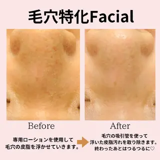 PRETTIEST SHINE所属・山田 浩子のエステ・リラクイメージ