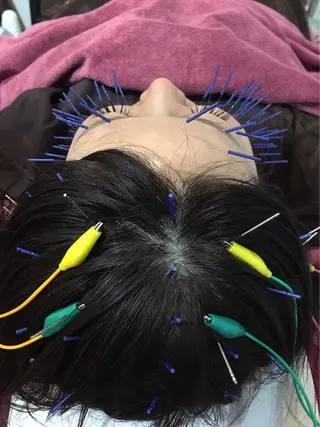 美容鍼灸女性専用 りんご鍼灸治療院のその他イメージ