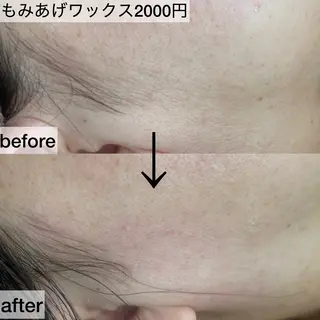 毛穴専門サロン　フルール所属・フルールFululu 自由が丘のエステ・リラクイメージ
