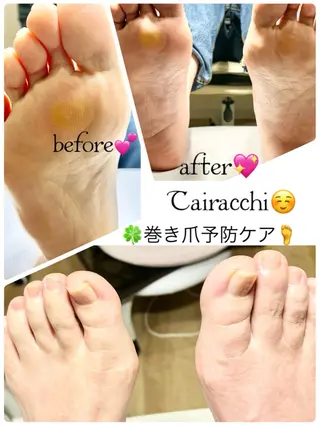 ネイル Tairacchi ﾀｲﾗｯﾁのエステ・リラクイメージ