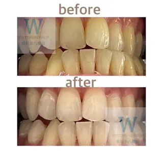 ホワイトニング ショップ本八幡店のエステ・リラクイメージ