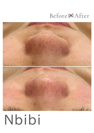 韓国🇰🇷価格 サロン_Nbibiのエステ・リラクイメージ