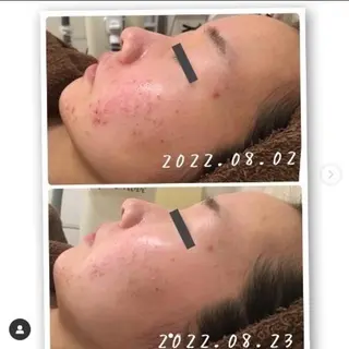 アルカンジュ~archange~所属・痩身/毛穴洗浄/脱毛 アルカンジュのエステ・リラクイメージ