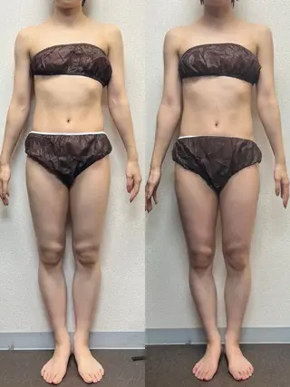 ハイパーナイフ専門店 Salon de COCO所属・Salon de COCOのエステ・リラクイメージ