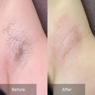 産毛専門店 Bittoのエステ・リラクイメージ