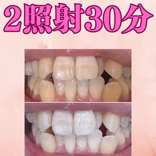 soerute所属・オーラルケアサロン soeruteのその他イメージ