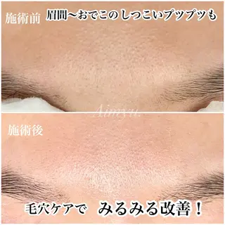 毛穴ケア専門店 Aimyu.のエステ・リラクイメージ