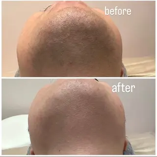 メンズ Amaryllis 🌹松本のエステ・リラクイメージ