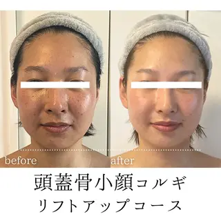 頭蓋骨小顔コルギPerm所属・頭蓋骨小顔コルギ Permのその他イメージ