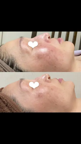 brilliance所属・老化肌トラブル肌専門 Brillianceのエステ・リラクイメージ