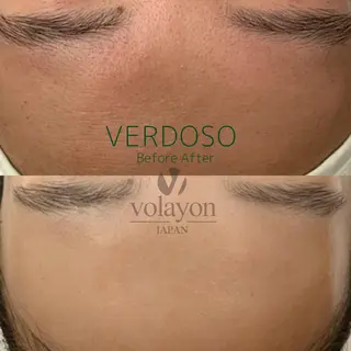 韓国風eyelush 眉毛サロン/Suuのマツエク・マツパデザイン