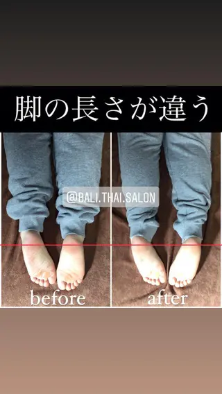 🌈歪み改善🌈 バリンタイ すぎうらのエステ・リラクイメージ