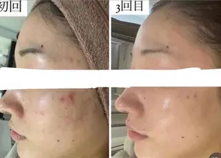 中目黒ハーブピーリン グ🌿ララピールのエステ・リラクイメージ