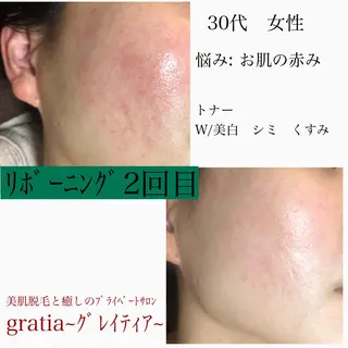 美肌脱毛と癒しのプライベートサロン。gratia~グレイティア~所属・gratia ~グレイティア~のエステ・リラクイメージ