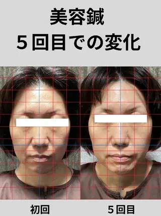 鍼灸整体院アレンジ所属・鍼灸整体院 アレンジのその他イメージ