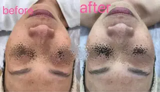 Nature Souce毛穴専門店のその他イメージ