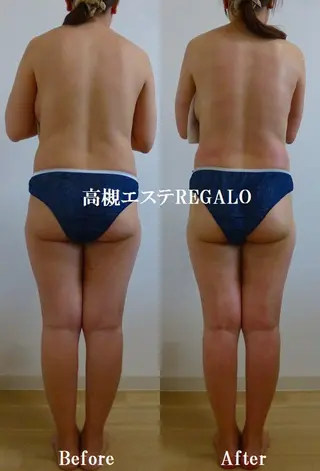 REGALO所属・矢野 さやかのエステ・リラクイメージ