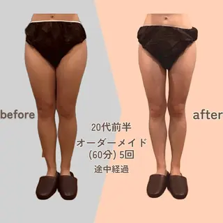 痩身エステ Julien麹町店のエステ・リラクイメージ